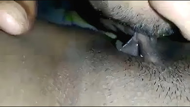 1000056474
