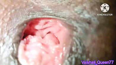 Desi Indian bhabhi’s chut was torn and kept deep hole chut