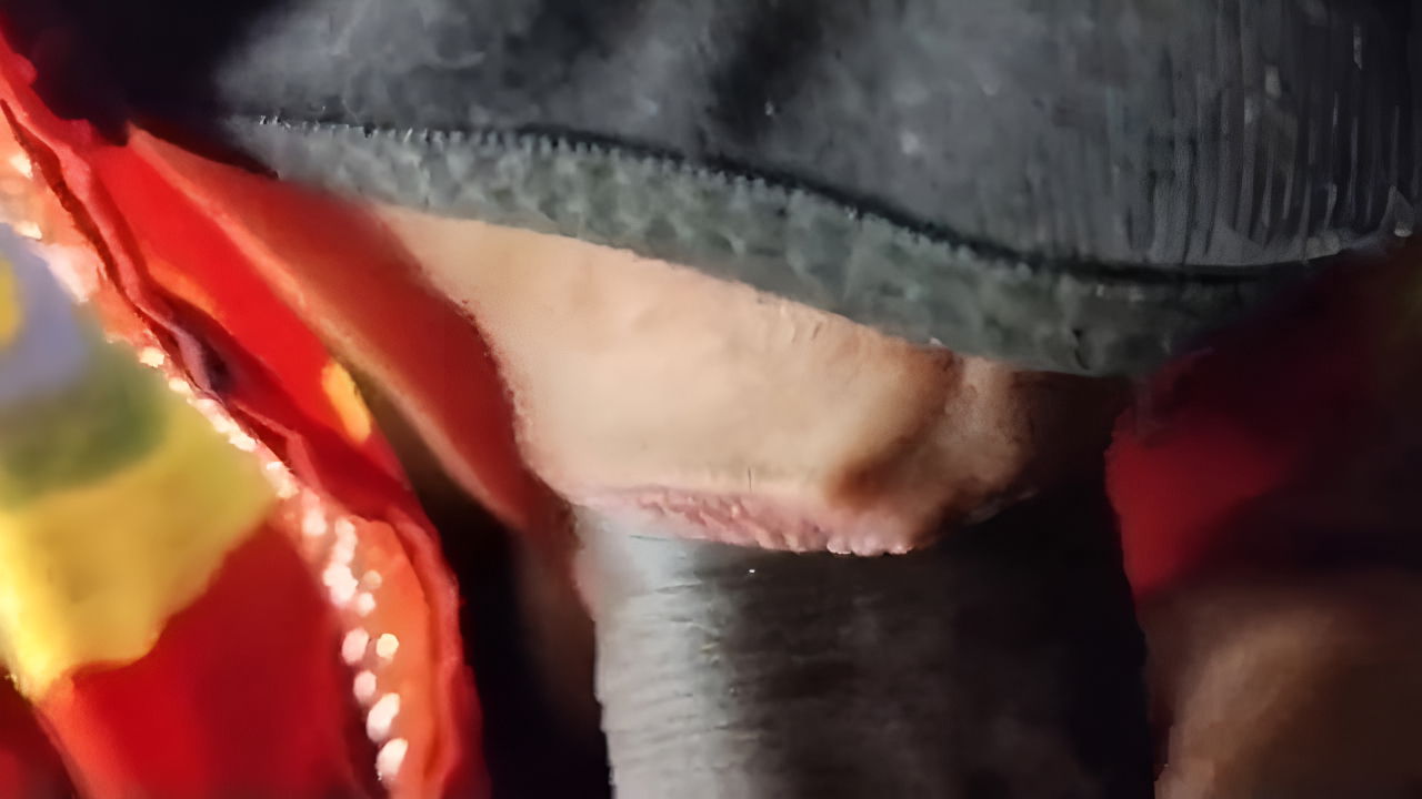 Doctor I’m so Thirsty Give Me All U Have