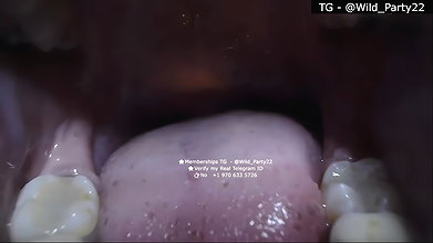 Zuby_duby 2 private show